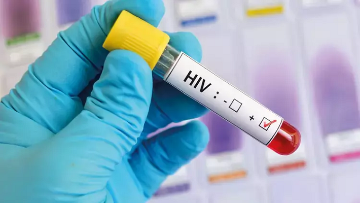 İngiltere’de HIV skandalı