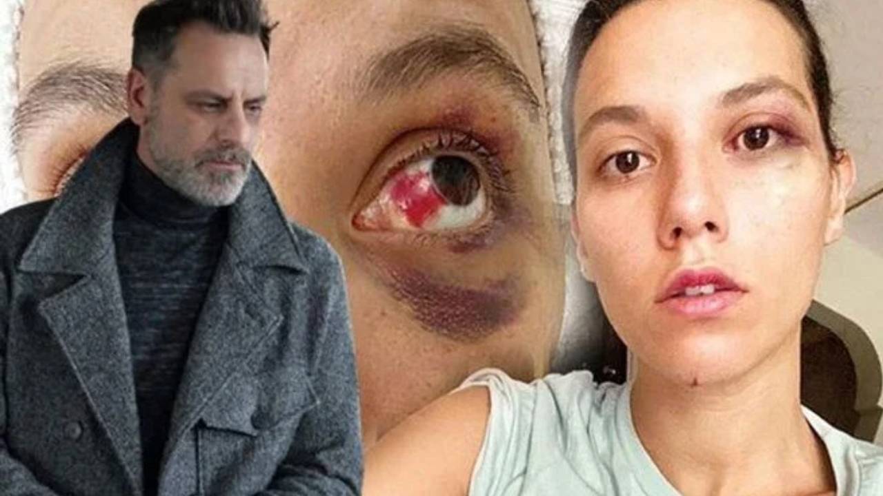 Ozan Güven'e hapis cezası